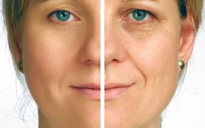 Transform Your Look with Premium Dermal Fillers in Beverly Hills